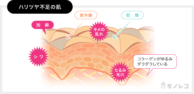 劣化したコラーゲンをわかりやすく説明しているイラスト画像