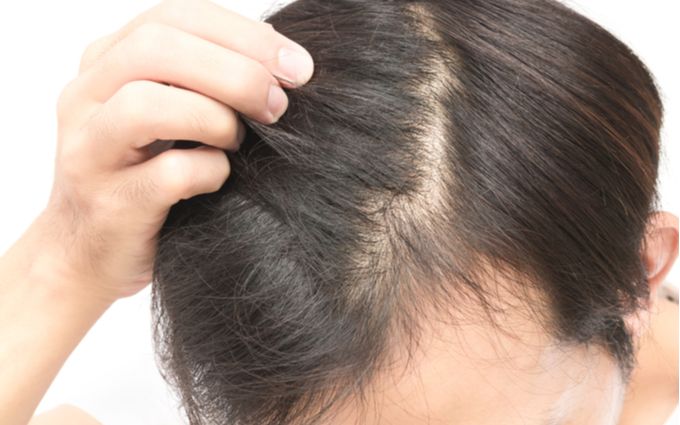 男性向け育毛シャンプーおすすめ28選 毛髪診断士が選び方や正しい洗い方を解説 モノレコ By Ameba