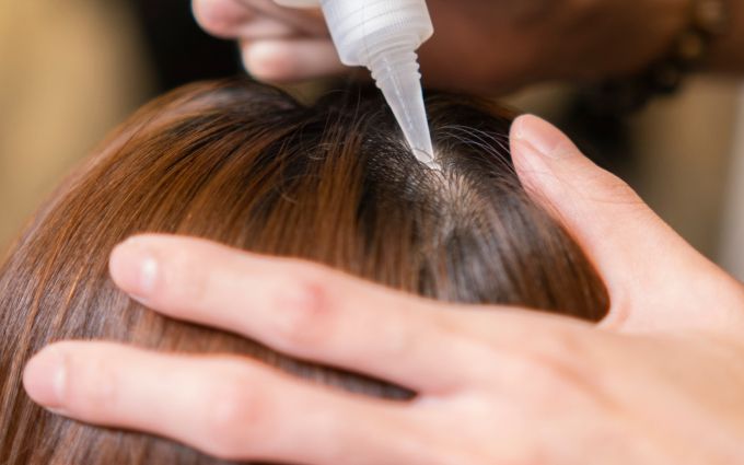 育毛剤のノズルをあてられている女性の画像