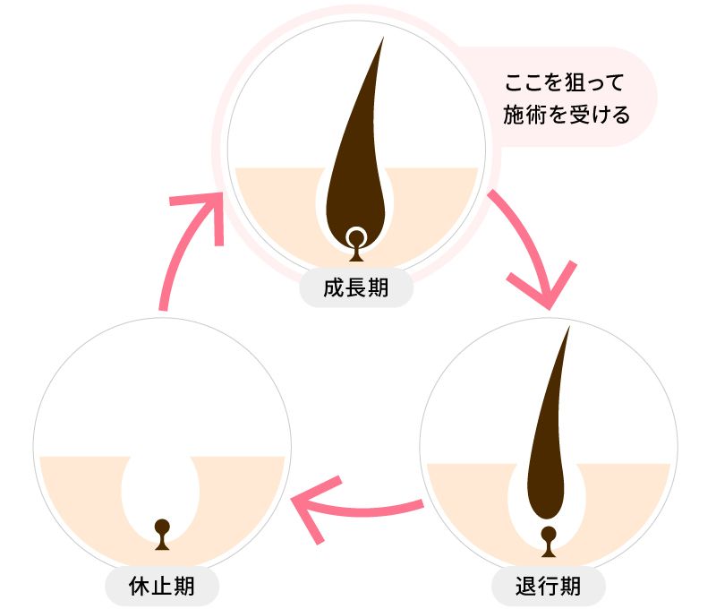 光脱毛の効果はどれくらいで出る 最新情報を踏まえて特徴などを徹底解説 Lessmo レスモ By Ameba