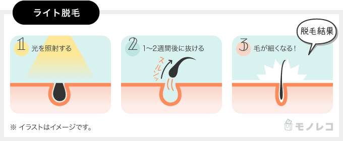 ライト脱毛の仕組みのイラスト画像