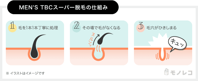 MEN'S TBCのスーパー脱毛の仕組みの画像