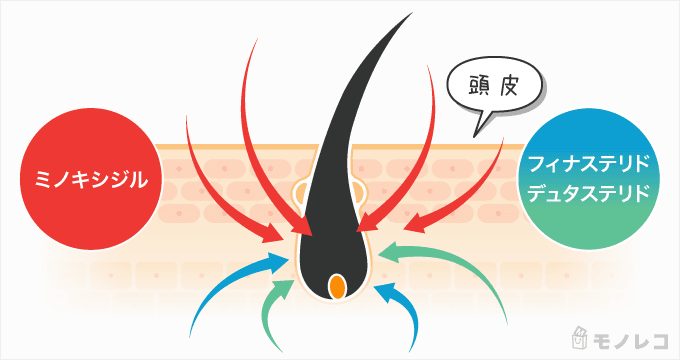 ミノキシジル、フィナステリド、デュタステリドを説明するイラスト画像