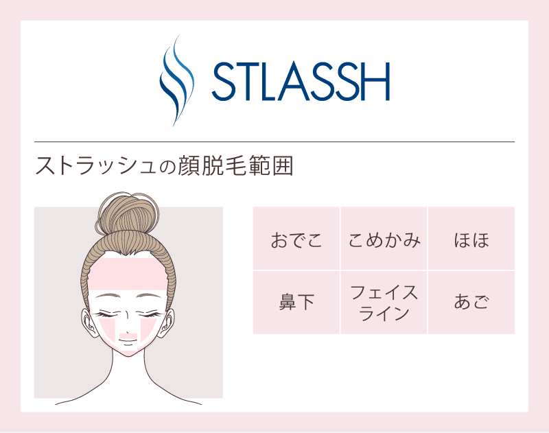 もみあげ脱毛で失敗しない理想の形は 自分で処理する方法とおすすめサロン5選 Lessmo レスモ By Ameba