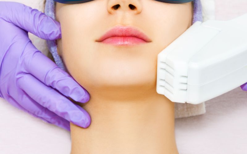 あご脱毛って女性も必要 美容脱毛と医療脱毛の必要回数や料金も紹介 Lessmo レスモ By Ameba